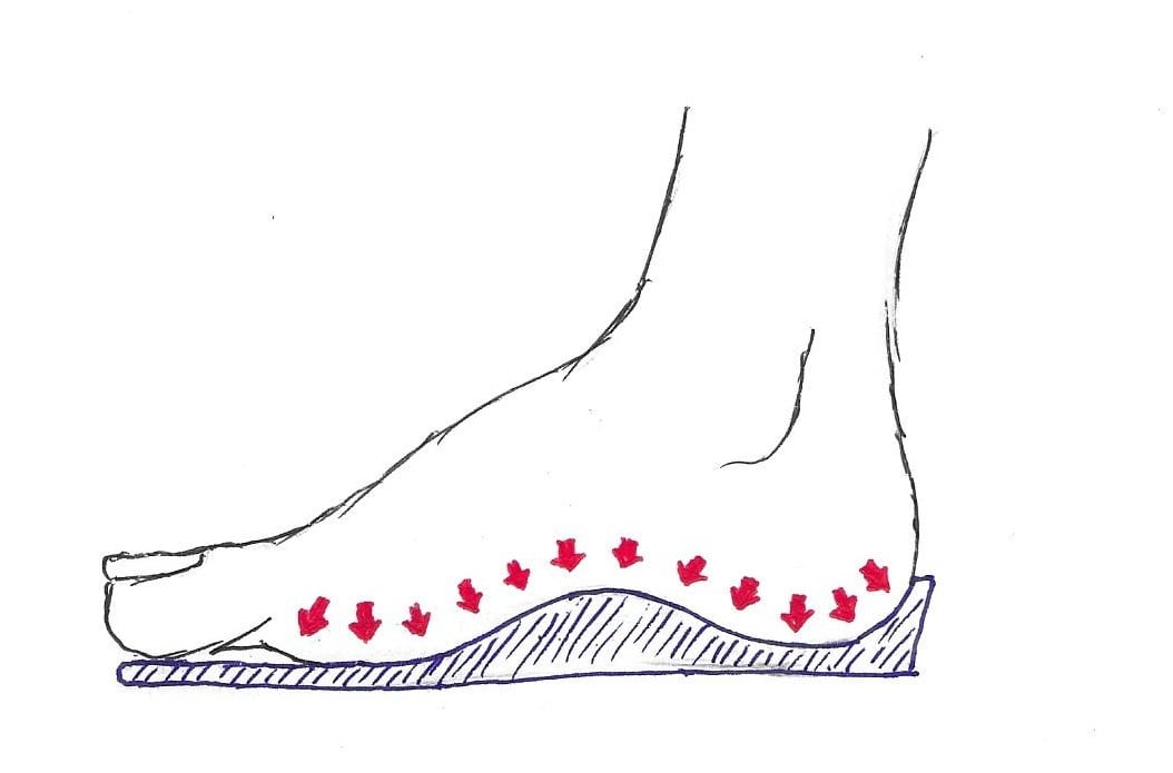 Why Are Insoles Important?