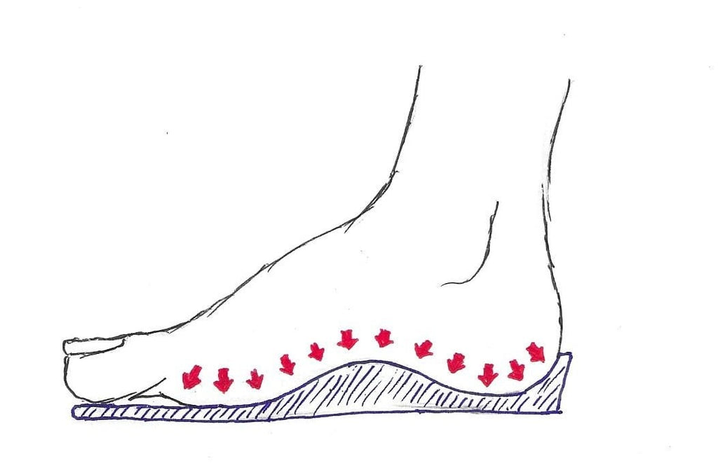 Why Are Insoles Important?