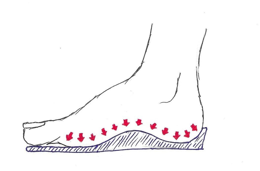 Why Are Insoles Important?